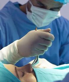 Durchführung einer geschlossenen plastischen Chirurgie der Nase